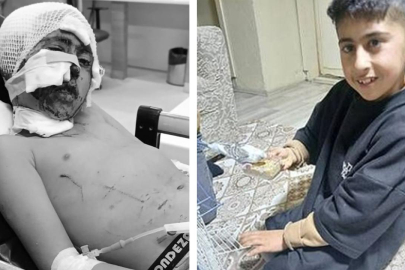 ERZURUM'DA BAŞIBOŞ KÖPEKLERİN SALDIRDIĞI ÇOCUK AĞIR YARALANDI